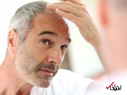 این خوراکیها باعث پرپشتتر شدن موهای شما میشود - 0